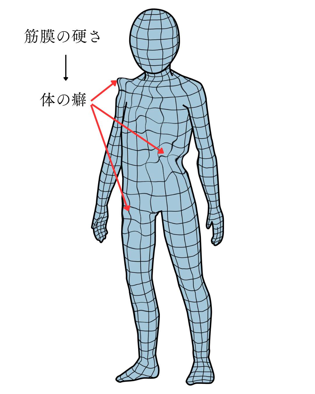 筋膜の硬さが体の癖として複数の場所に影響するイメージ図